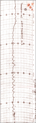 Note from Tolcher to Hadley concerning electrical heating in Director's Suite (issues with installation, the Director is a fresh air fiend, his secretary found it too hot; includes temperature plots, 18 December 1962)